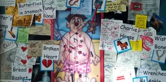 A Man’s Obsession With the Game ‘Operation’ Leads to Tragedy in a Surreal Saturday Night Live UK Sketch